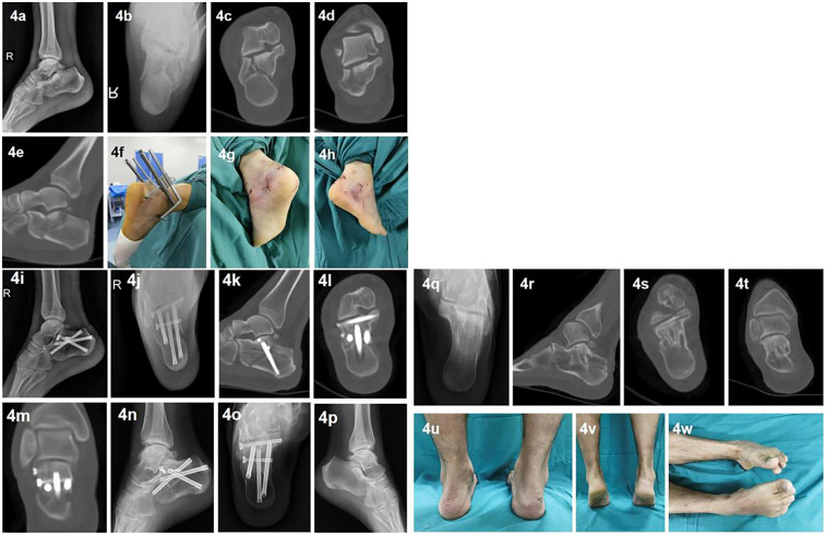 Figure 4