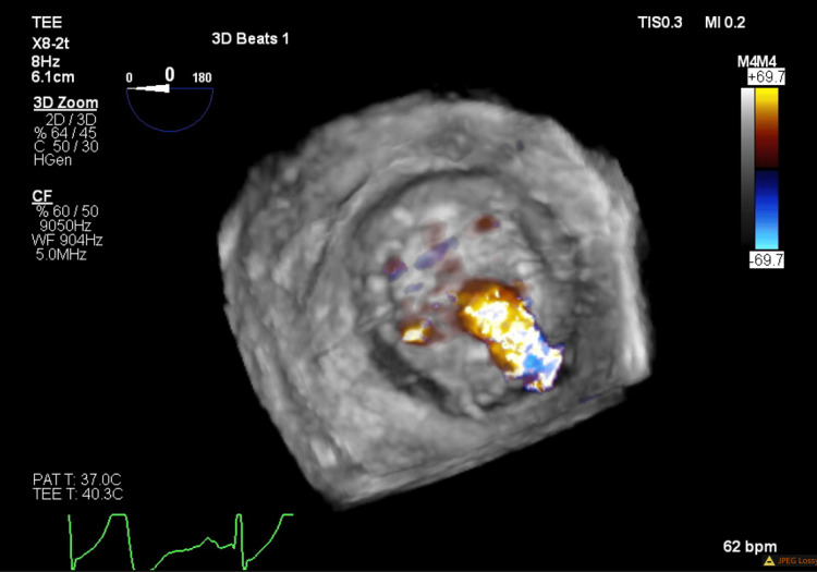 Figure 4