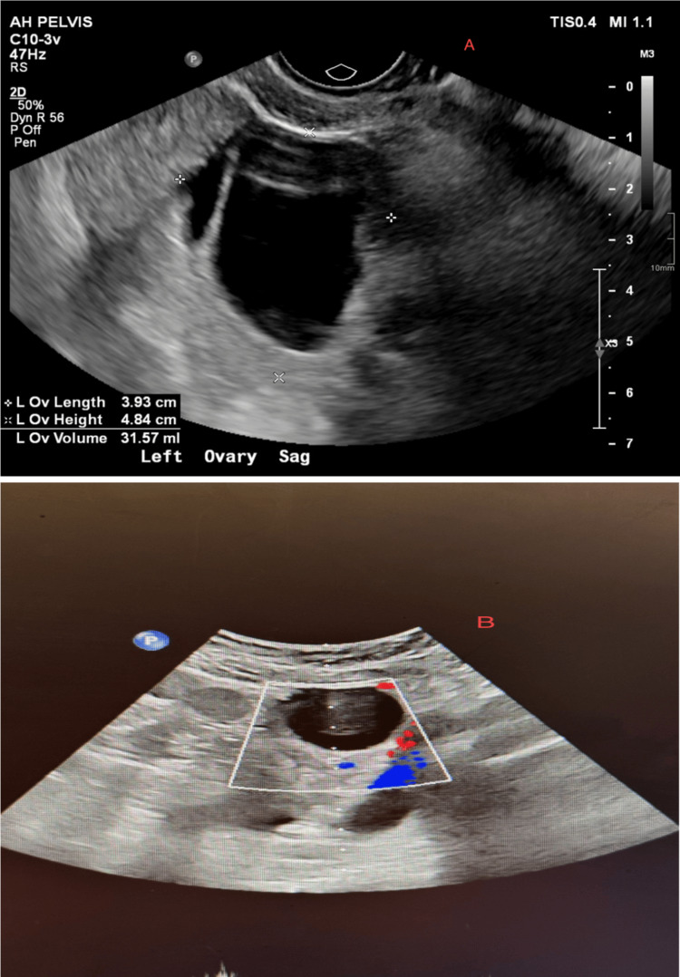 Figure 3