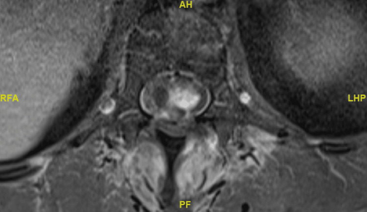 Figure 13