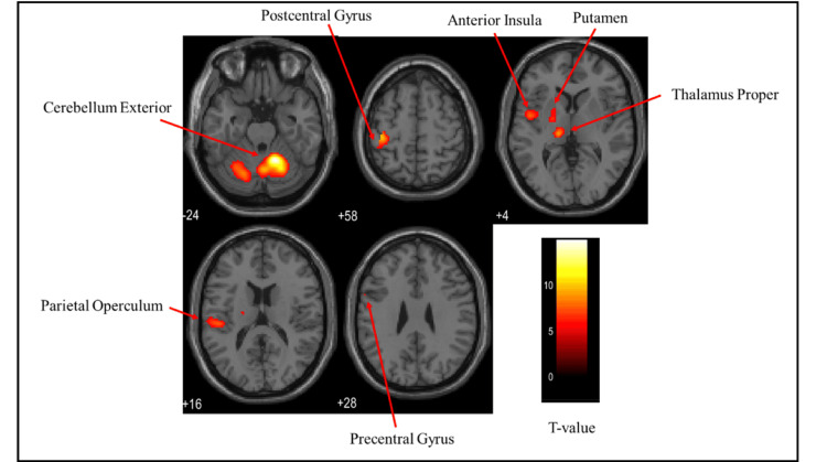 Figure 6