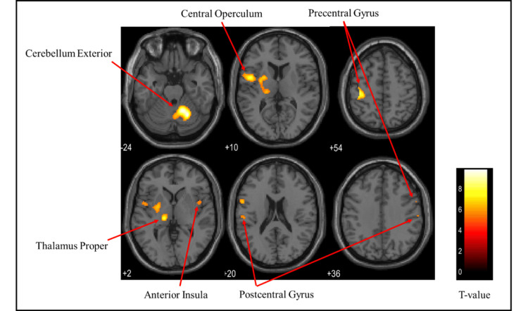 Figure 11