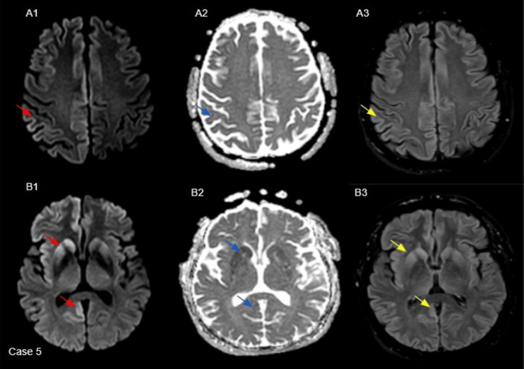 Figure 5