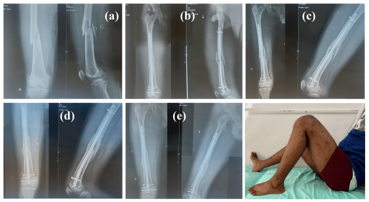 Figure 4