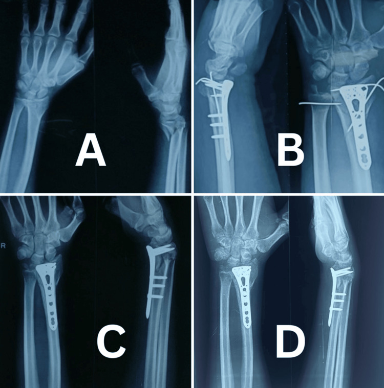 Figure 5
