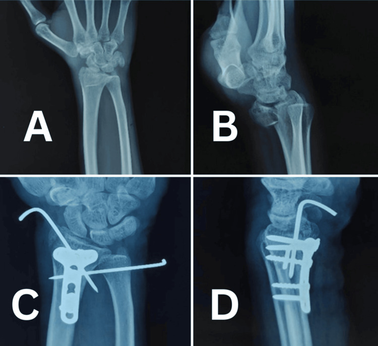 Figure 7