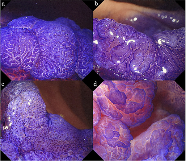 FIGURE 1