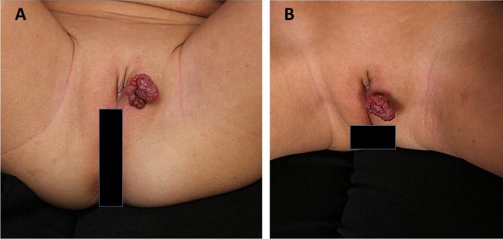 FIGURE 1