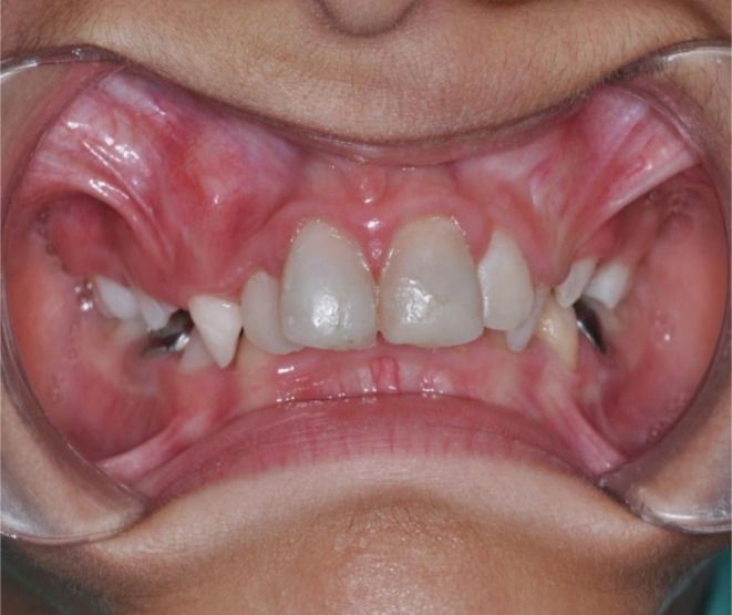 FIGURE 6