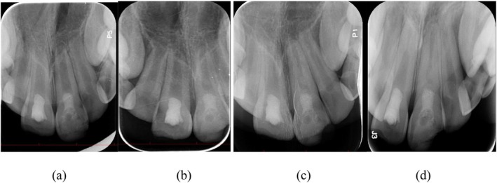 FIGURE 5