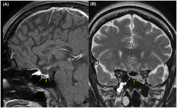 Figure 2