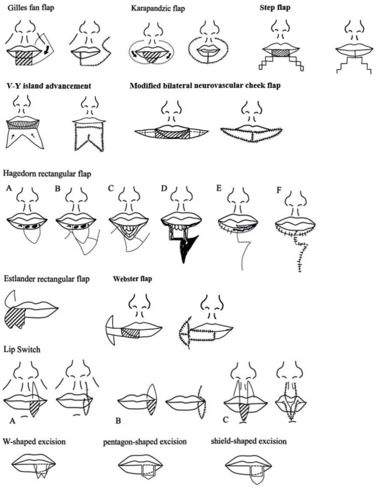 Figure 8