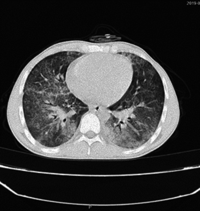 FIGURE 3