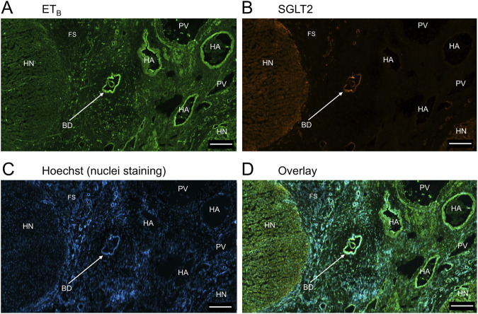 FIGURE 11