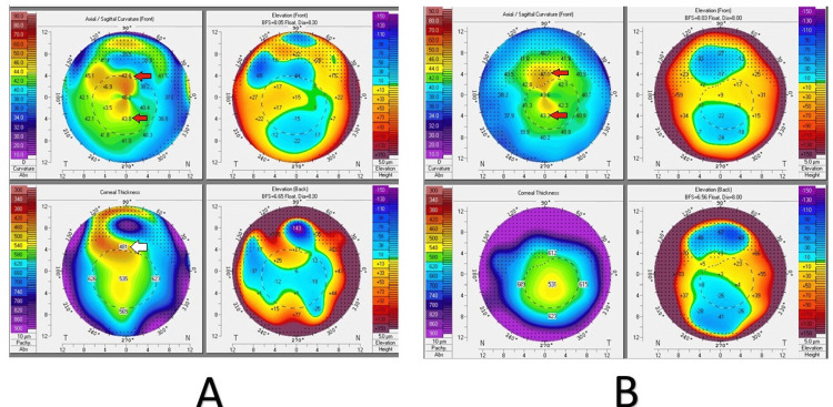 Figure 4