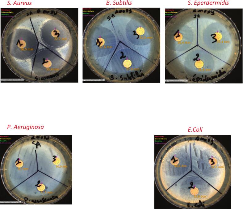Figure 15