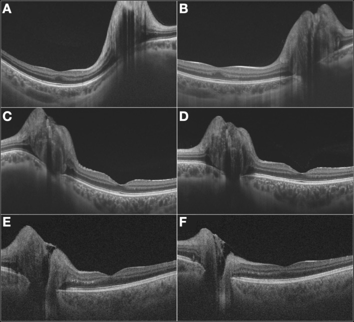 FIGURE 2