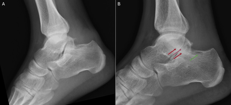 Figure 7