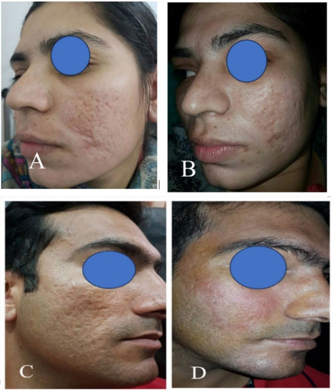 FIGURE 3