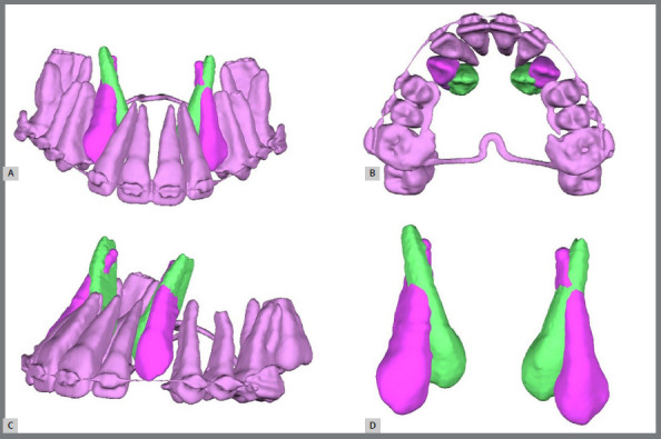 Figure 11