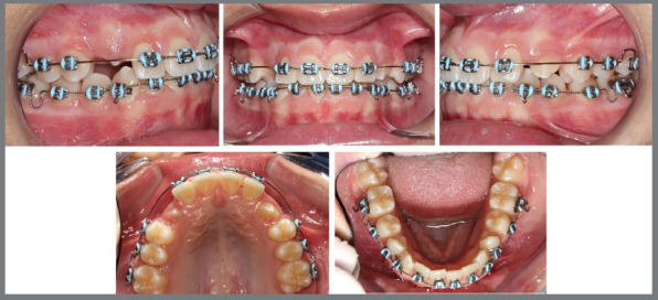 Figure 14