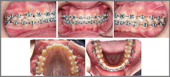 Figure 15