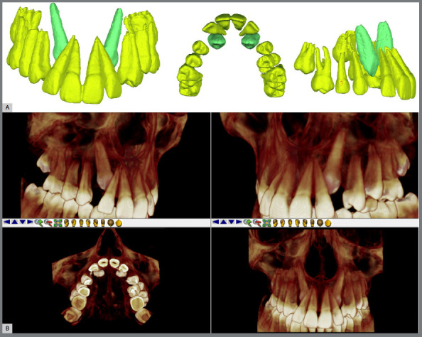 Figure 18