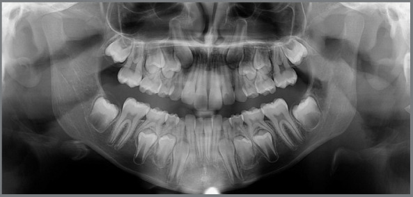 Figure 19