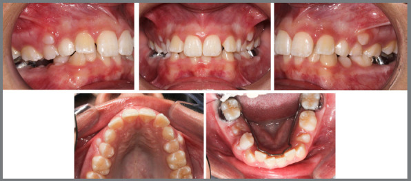 Figure 20