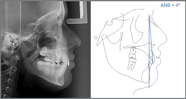 Figure 22