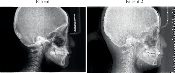 Figure 6