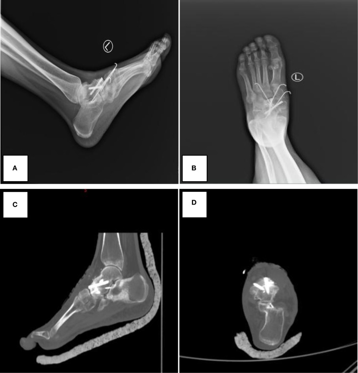 Figure 2