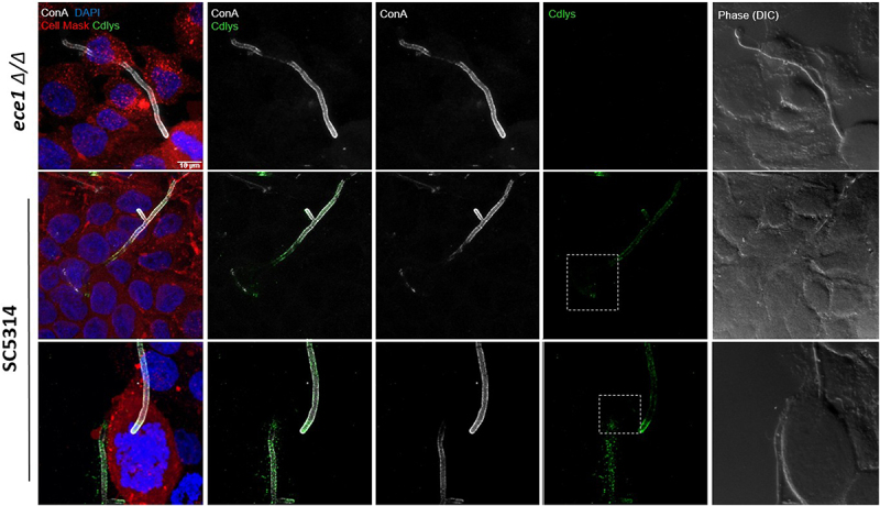 Figure 11