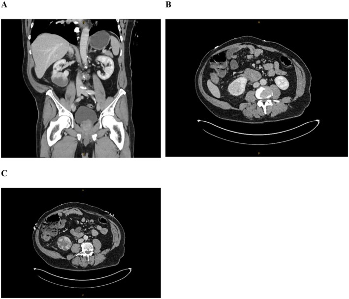 FIGURE 3