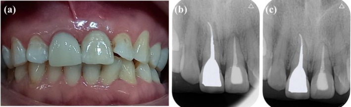 FIGURE 4