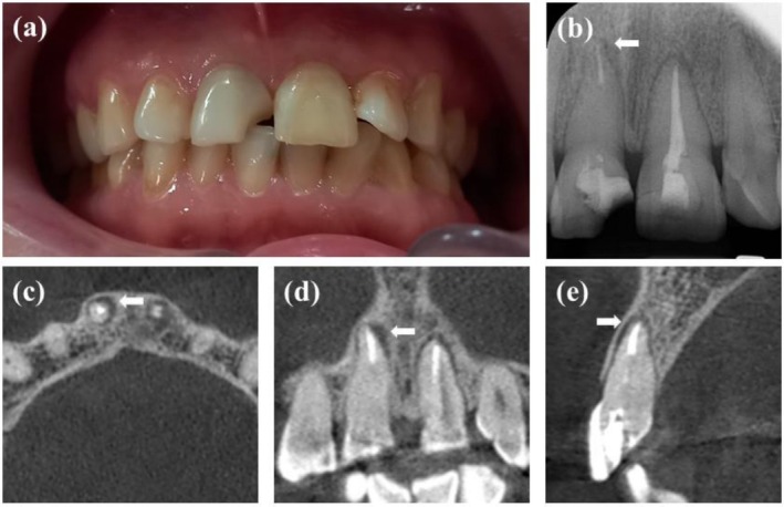 FIGURE 1