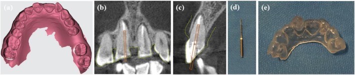 FIGURE 2