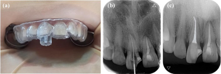 FIGURE 3