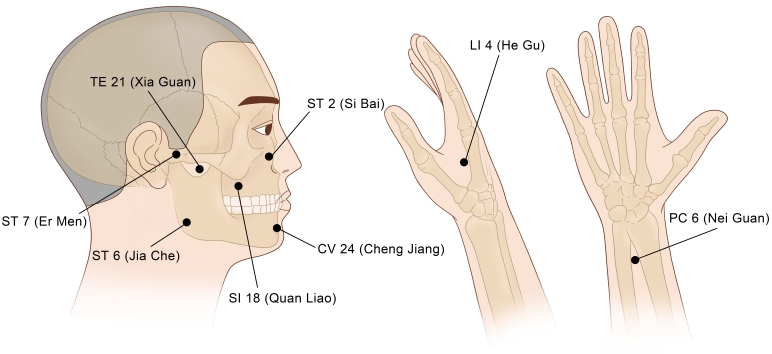 Fig. 2