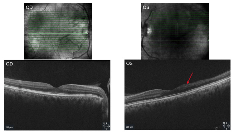 Figure 6