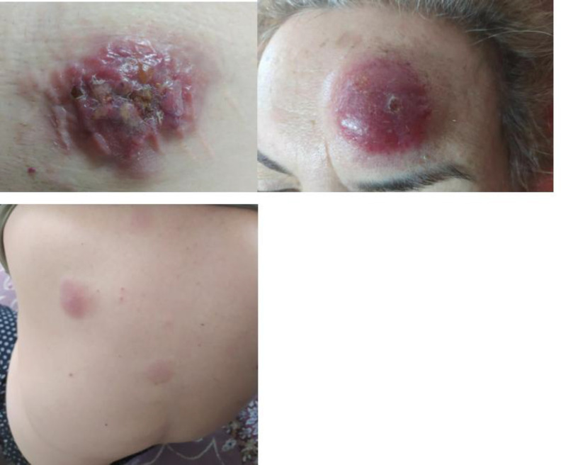 Fig. 1