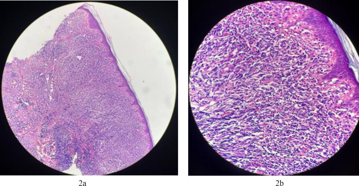 Fig. 2a