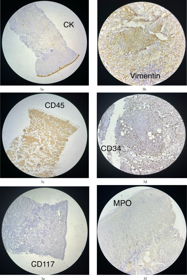 Fig.3a