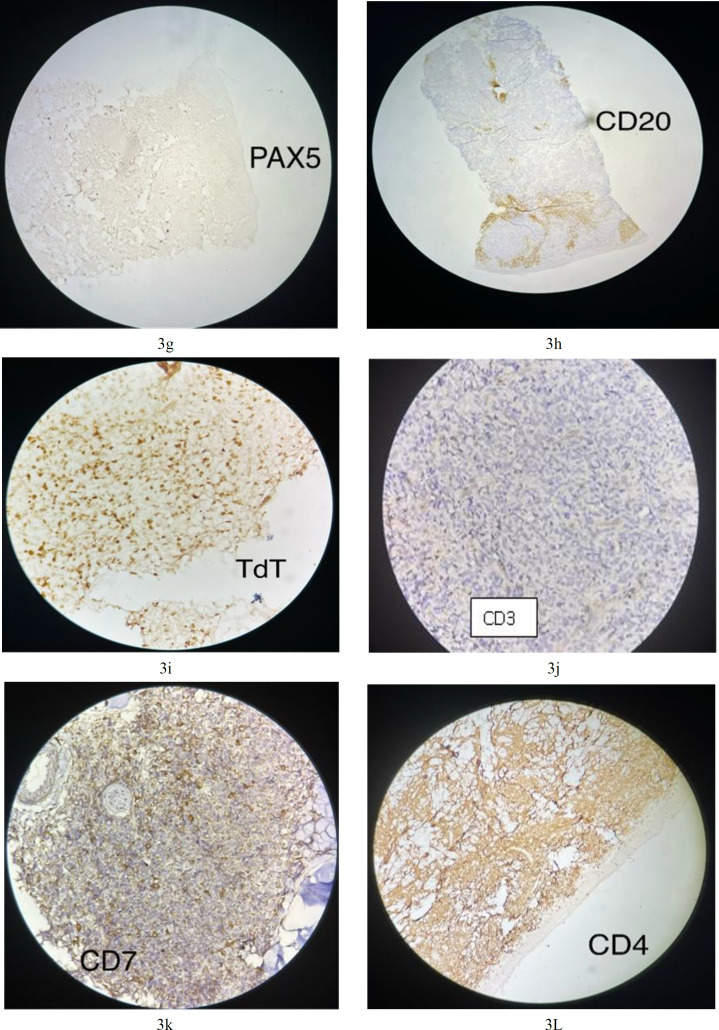 Fig.3g