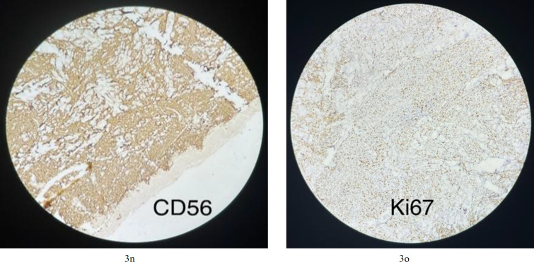 Fig.3n