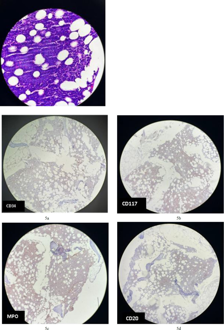 Fig.4c