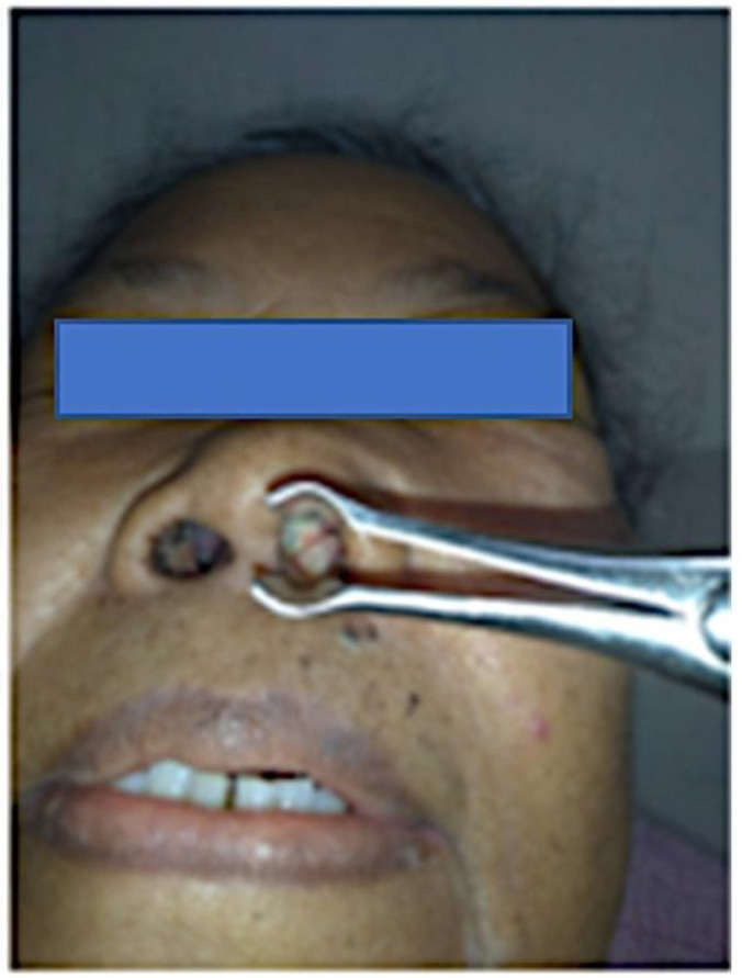 Fig. 1