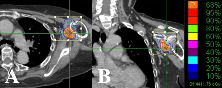 Figure 6