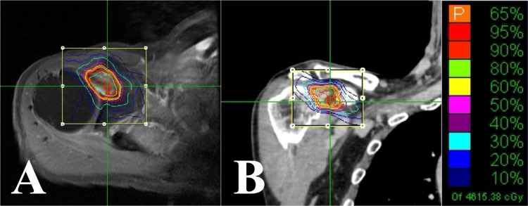 Figure 9