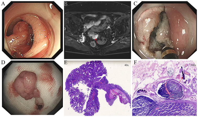 Figure 2